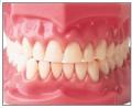 Denture