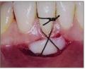 Periodontics Periodontics