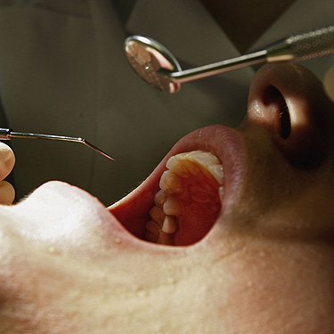 Dental Procedure